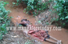 Kundapur: Elderly lady dies falling into drain
